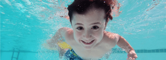 Tratamento Químico de Piscinas em Jacarepaguá - RJ